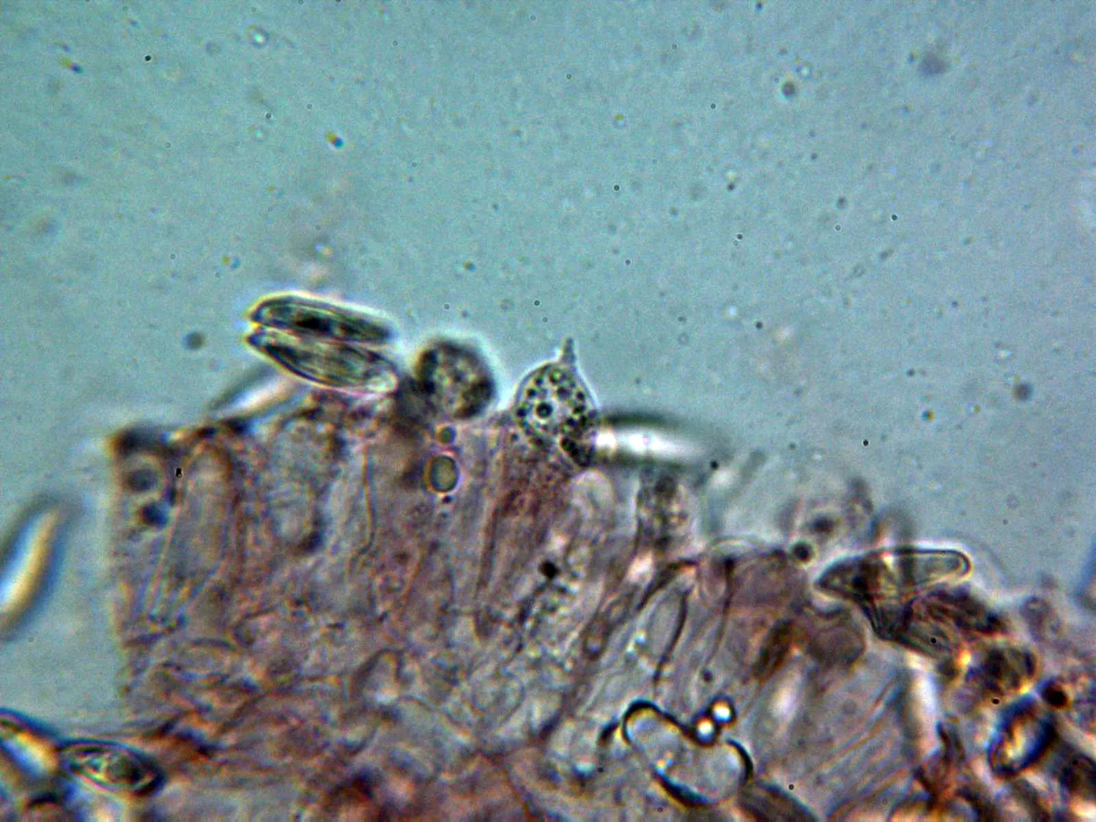 Microscopía de Lepiota magnispora - 10 - Basidios 2